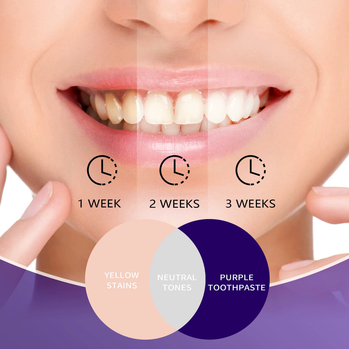 Révélez l’éclat de votre sourire avec Glory Smile V34